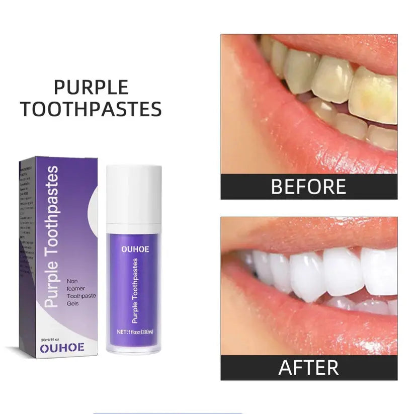 OUHOE Teeth Whitening Toothpaste