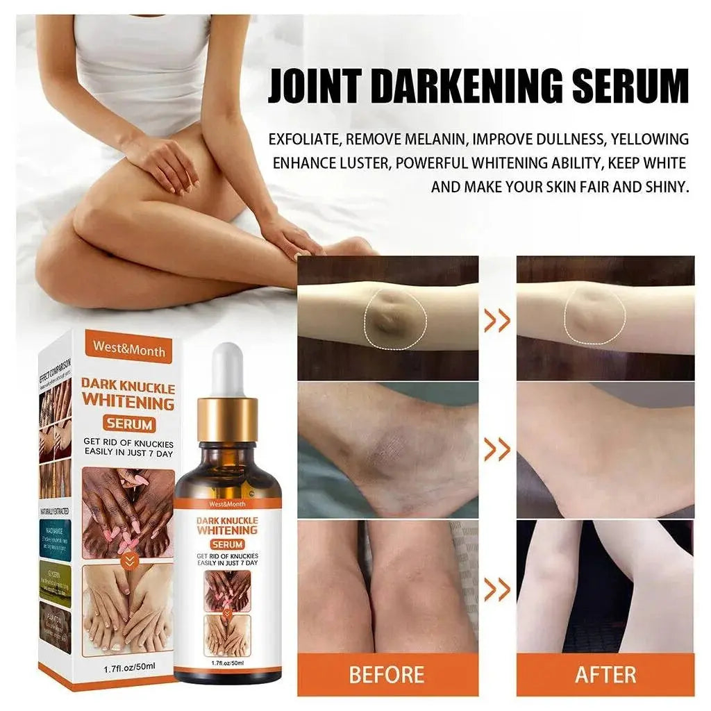 West & Month Strong Whitening Serum For Removing Dark Finger Knuckle Elbow Knee 50ml DexKea