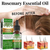 EELHOE Rosemary Oil for Hair Growth My Store